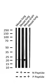 STMN1 / Stathmin / LAG Antibody - Western blot analysis of Phospho-Stathmin 1 (Ser37) expression in various lysates