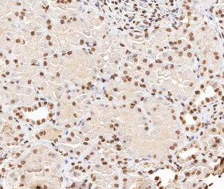 STMN1 / Stathmin / LAG Antibody - 1:200 staining human kidney tissue by IHC-P. The tissue was formaldehyde fixed and a heat mediated antigen retrieval step in citrate buffer was performed. The tissue was then blocked and incubated with the antibody for 1.5 hours at 22°C. An HRP conjugated goat anti-rabbit antibody was used as the secondary.