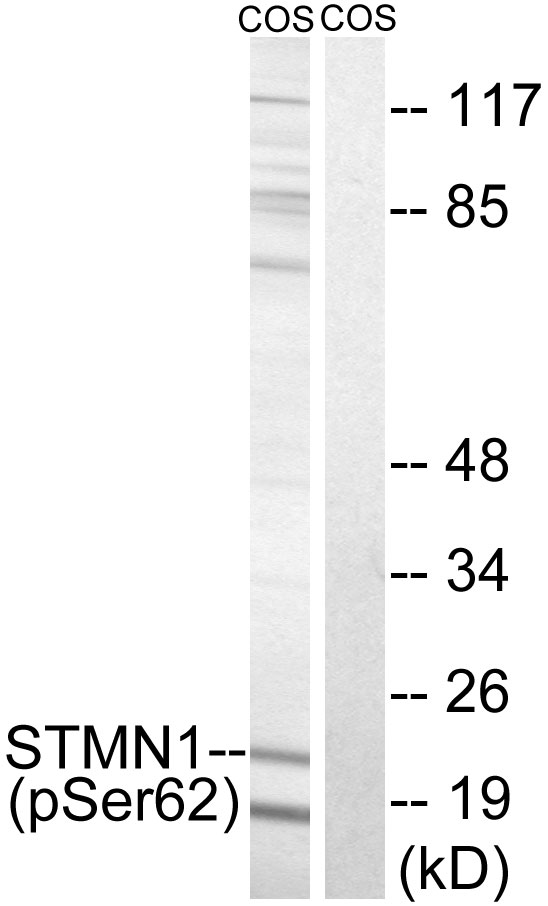STMN1 / Stathmin / LAG Antibody - Western blot analysis of lysates from COS7 cells treated with nocodazole 1ug/ml 16h, using STMN1 (Phospho-Ser62) Antibody. The lane on the right is blocked with the phospho peptide.