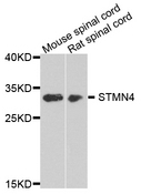 STMN4 / RB3 Antibody - Western blot analysis of extract of various cells.