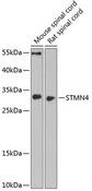 STMN4 / RB3 Antibody - Western blot analysis of extracts of various cell lines using STMN4 Polyclonal Antibody at dilution of 1:1000.