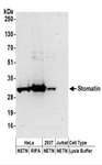 STOM / Stomatin Antibody - Detection of Human Stomatin by Western Blot. Samples: Whole cell lysate (50 ug) prepared using NETN and RIPA buffer from HeLa, 293T, and Jurkat cells. Antibodies: Affinity purified rabbit anti-Stomatin antibody used for WB at 0.4 ug/ml. Detection: Chemiluminescence with an exposure time of 3 minutes.