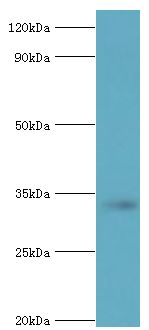 STOM / Stomatin Antibody - Western blot. All lanes: Erythrocyte band 7 integral membrane protein antibody at 5 ug/ml+mouse liver tissue. Secondary antibody: Goat polyclonal to rabbit at 1:10000 dilution. Predicted band size: 32 kDa. Observed band size: 32 kDa Immunohistochemistry.