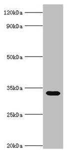 STOM / Stomatin Antibody - Western blot All lanes: Erythrocyte band 7 integral membrane protein antibody at 5µg/ml + Mouse liver tissue Secondary Goat polyclonal to rabbit IgG at 1/10000 dilution Predicted band size: 32, 14 kDa Observed band size: 32 kDa