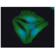 STOM / Stomatin Antibody - ICC/IF analysis of STOM in HeLa cells line, stained with DAPI (Blue) for nucleus staining and monoclonal anti-human STOM antibody (1:100) with goat anti-mouse IgG-Alexa fluor 488 conjugate (Green).