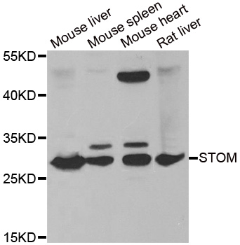 STOM / Stomatin Antibody - Western blot analysis of extracts of various tissues.