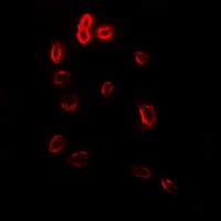 STOM / Stomatin Antibody - Immunofluorescent analysis of Stomatin staining in HeLa cells. Formalin-fixed cells were permeabilized with 0.1% Triton X-100 in TBS for 5-10 minutes and blocked with 3% BSA-PBS for 30 minutes at room temperature. Cells were probed with the primary antibody in 3% BSA-PBS and incubated overnight at 4 deg C in a humidified chamber. Cells were washed with PBST and incubated with a DyLight 594-conjugated secondary antibody (red) in PBS at room temperature in the dark.