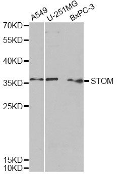 STOM / Stomatin Antibody - Western blot analysis of extracts of various cell lines, using STOM antibody at 1:1000 dilution. The secondary antibody used was an HRP Goat Anti-Rabbit IgG (H+L) at 1:10000 dilution. Lysates were loaded 25ug per lane and 3% nonfat dry milk in TBST was used for blocking. An ECL Kit was used for detection and the exposure time was 90s.