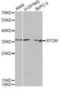 STOM / Stomatin Antibody - Western blot analysis of extracts of various cell lines, using STOM antibody at 1:1000 dilution. The secondary antibody used was an HRP Goat Anti-Rabbit IgG (H+L) at 1:10000 dilution. Lysates were loaded 25ug per lane and 3% nonfat dry milk in TBST was used for blocking. An ECL Kit was used for detection and the exposure time was 90s.