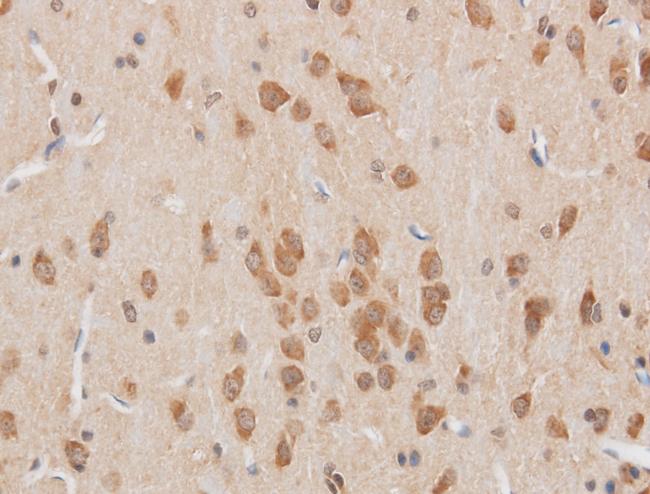 STOM / Stomatin Antibody - Immunohistochemistry of paraffin-embedded Mouse brain using STOM Polyclonal Antibody at dilution of 1:50.