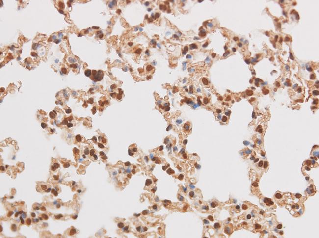 STOM / Stomatin Antibody - Immunohistochemistry of paraffin-embedded Rat lung using STOM Polyclonal Antibody at dilution of 1:50.