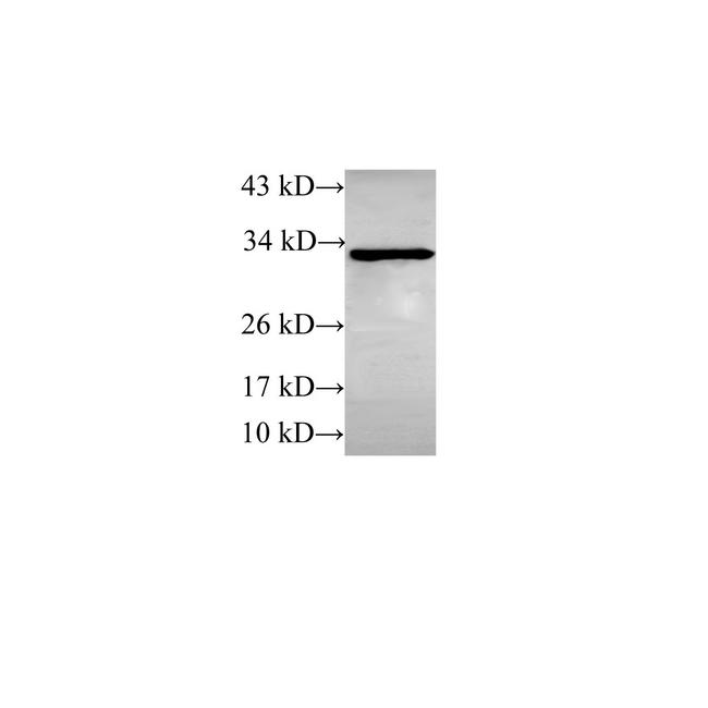 STOM / Stomatin Antibody - Western Blot analysis of Rat heart using STOM Polyclonal Antibody at dilution of 1:600.