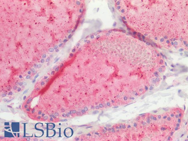 STOML2 Antibody - Human Thyroid, Paraffin-Embedded (FFPE)