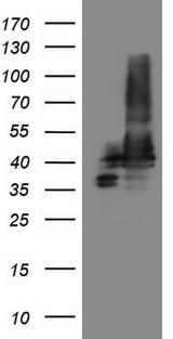 STOML2 Antibody - HEK293T cells were transfected with the pCMV6-ENTRY control. (Left lane) or pCMV6-ENTRY STOML2. (Right lane) cDNA for 48 hrs and lysed. Equivalent amounts of cell lysates. (5 ug per lane) were separated by SDS-PAGE and immunoblotted with anti-STOML2. (1:2000)