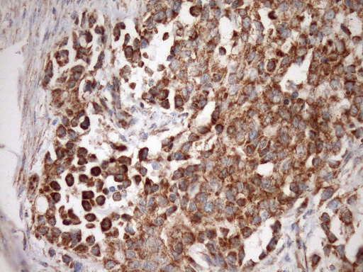 STOML2 Antibody - Immunohistochemical staining of paraffin-embedded Human bladder tissue within the normal limits using anti-STOML2 mouse monoclonal antibody. (Heat-induced epitope retrieval by Tris-EDTA, pH8.0)(1:150)