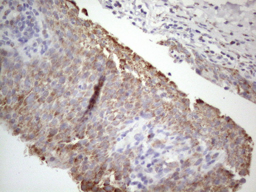 STOML2 Antibody - Immunohistochemical staining of paraffin-embedded Human bladder tissue within the normal limits using anti-STOML2 mouse monoclonal antibody. (Heat-induced epitope retrieval by 1mM EDTA in 10mM Tris buffer. (pH8.5) at 120°C for 3 min. (1:150)