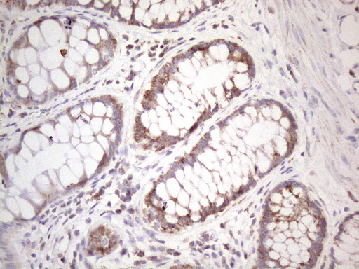 STOML2 Antibody - Immunohistochemical staining of paraffin-embedded Human colon tissue within the normal limits using anti-STOML2 mouse monoclonal antibody. (Heat-induced epitope retrieval by 1mM EDTA in 10mM Tris buffer. (pH8.5) at 120°C for 3 min. (1:150)