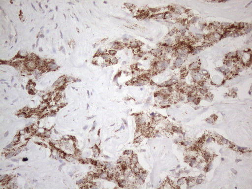 STOML2 Antibody - Immunohistochemical staining of paraffin-embedded Human liver tissue within the normal limits using anti-STOML2 mouse monoclonal antibody. (Heat-induced epitope retrieval by 1mM EDTA in 10mM Tris buffer. (pH8.5) at 120°C for 3 min. (1:150)