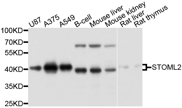 STOML2 Antibody - Western blot analysis of extracts of various cell lines, using STOML2 antibody at 1:1000 dilution. The secondary antibody used was an HRP Goat Anti-Rabbit IgG (H+L) at 1:10000 dilution. Lysates were loaded 25ug per lane and 3% nonfat dry milk in TBST was used for blocking. An ECL Kit was used for detection and the exposure time was 10s.