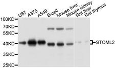 STOML2 Antibody - Western blot analysis of extracts of various cell lines, using STOML2 antibody at 1:1000 dilution. The secondary antibody used was an HRP Goat Anti-Rabbit IgG (H+L) at 1:10000 dilution. Lysates were loaded 25ug per lane and 3% nonfat dry milk in TBST was used for blocking. An ECL Kit was used for detection and the exposure time was 10s.