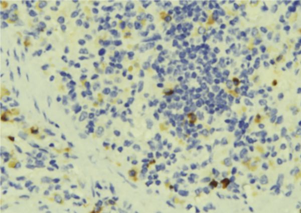 STOML2 Antibody - 1:100 staining human lymph tissue by IHC-P. The sample was formaldehyde fixed and a heat mediated antigen retrieval step in citrate buffer was performed. The sample was then blocked and incubated with the antibody for 1.5 hours at 22°C. An HRP conjugated goat anti-rabbit antibody was used as the secondary.