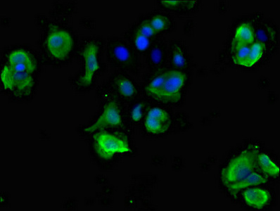 STOML3 Antibody - Immunofluorescent analysis of MCF-7 cells diluted at 1:100 and Alexa Fluor 488-congugated AffiniPure Goat Anti-Rabbit IgG(H+L)