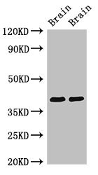 STOML3 Antibody - Western Blot Positive WB detected in:Rat brain tissue,Mouse brain tissue All Lanes:STOML3 antibody at 3.4µg/ml Secondary Goat polyclonal to rabbit IgG at 1/50000 dilution Predicted band size: 33,32 KDa Observed band size: 40 KDa