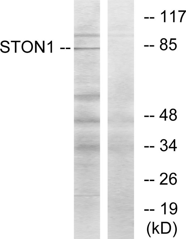 STON1 Antibody - Western blot analysis of lysates from K562 cells, using STON1 Antibody. The lane on the right is blocked with the synthesized peptide.