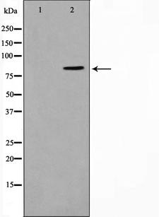 STON1 Antibody - Western blot analysis on K562 cell lysates using STON1 antibody. The lane on the left is treated with the antigen-specific peptide.