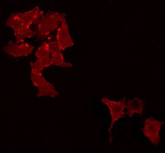 STON1 Antibody - Staining HeLa cells by IF/ICC. The samples were fixed with PFA and permeabilized in 0.1% Triton X-100, then blocked in 10% serum for 45 min at 25°C. The primary antibody was diluted at 1:200 and incubated with the sample for 1 hour at 37°C. An Alexa Fluor 594 conjugated goat anti-rabbit IgG (H+L) Ab, diluted at 1/600, was used as the secondary antibody.