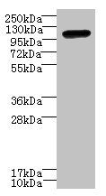 STOX1 Antibody - Western blot All lanes: STOX1 antibody at 8µg/ml + HepG2 whole cell lysate Secondary Goat polyclonal to rabbit IgG at 1/10000 dilution Predicted band size: 111, 26, 20 kDa Observed band size: 111 kDa