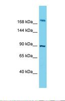 STOX2 Antibody - Western blot of Human ACHN. STOX2 antibody dilution 1.0 ug/ml.  This image was taken for the unconjugated form of this product. Other forms have not been tested.