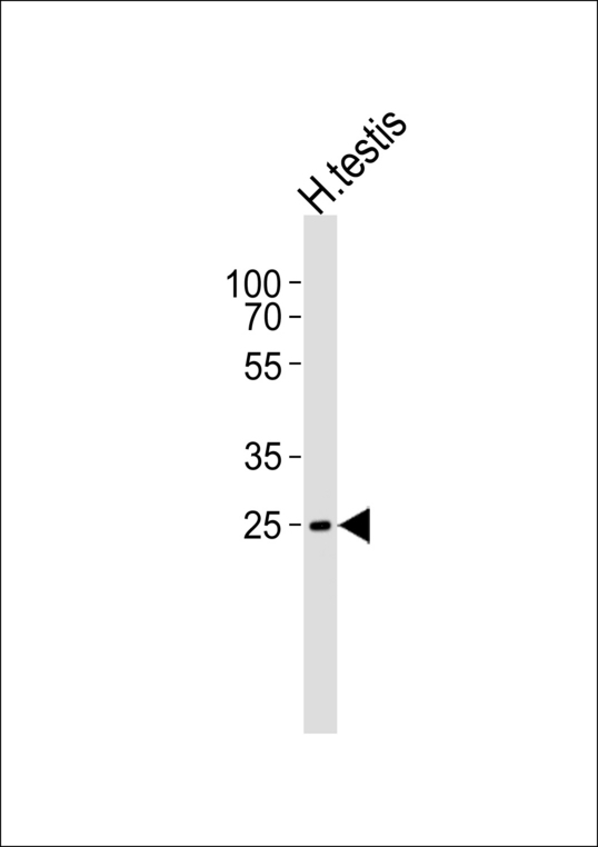 STPG1 Antibody - Western blot of lysate from human testis tissue lysate with C1orf201 Antibody. Antibody was diluted at 1:1000. A goat anti-rabbit IgG H&L (HRP) at 1:5000 dilution was used as the secondary antibody. Lysate at 35 ug.