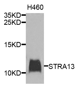 STRA13 Antibody - Western blot analysis of extracts of H460 cells.