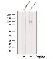 STRA6 Antibody - Western blot analysis of extracts of mouse liver tissue using STRA6 antibody. The lane on the left was treated with blocking peptide.