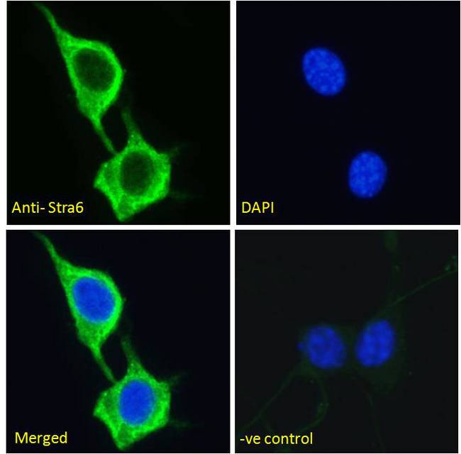 STRA6 Antibody - Stra6 antibody immunofluorescence analysis of paraformaldehyde fixed NIH3T3 cells, permeabilized with 0.15% Triton. Primary incubation 1hr (10ug/ml) followed by Alexa Fluor 488 secondary antibody (2ug/ml), showing vesicle staining. The nuclear stain is DAPI (blue).