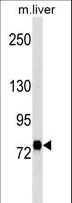 STRA6 Antibody - Rat Stra6 Antibody western blot of mouse liver tissue lysates (35 ug/lane). The Stra6 antibody detected the Stra6 protein (arrow).