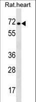 STRA6 Antibody - Rat Stra6 Antibody western blot of rat heart tissue lysates (35 ug/lane). The Stra6 antibody detected the Stra6 protein (arrow).