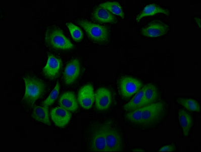 STRA6 Antibody - Immunofluorescence staining of A549 cells at a dilution of 1:100, counter-stained with DAPI. The cells were fixed in 4% formaldehyde, permeabilized using 0.2% Triton X-100 and blocked in 10% normal Goat Serum. The cells were then incubated with the antibody overnight at 4 °C.The secondary antibody was Alexa Fluor 488-congugated AffiniPure Goat Anti-Rabbit IgG (H+L) .