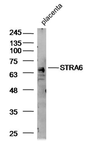 STRA6 Antibody - Tissue/cell:Placenta, primary antibody 1:300 overnight.