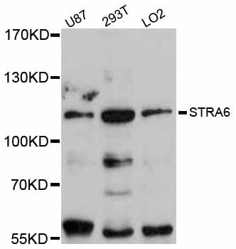 STRA6 Antibody - Western blot analysis of extracts of various cell lines, using STRA6 antibody at 1:3000 dilution. The secondary antibody used was an HRP Goat Anti-Rabbit IgG (H+L) at 1:10000 dilution. Lysates were loaded 25ug per lane and 3% nonfat dry milk in TBST was used for blocking. An ECL Kit was used for detection and the exposure time was 30s.