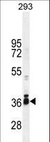 STRA8 Antibody - STRA8 Antibody western blot of 293 cell line lysates (35 ug/lane). The STRA8 antibody detected the STRA8 protein (arrow).