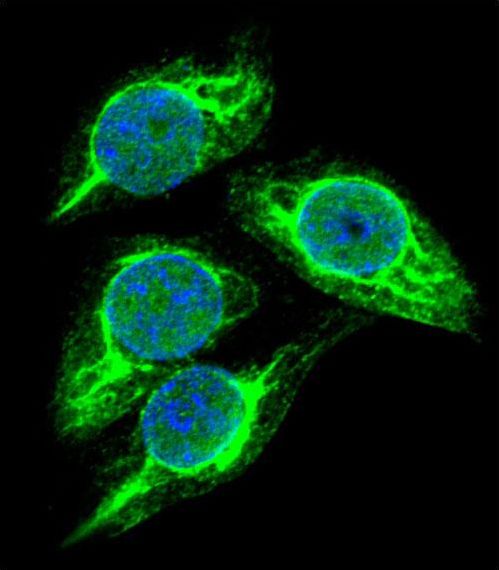 STRA8 Antibody - Confocal immunofluorescence of STRA8 Antibody with 293 cell followed by Alexa Fluor 488-conjugated goat anti-rabbit lgG (green). DAPI was used to stain the cell nuclear (blue).