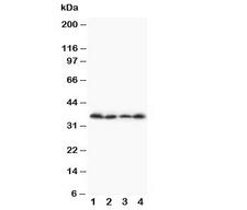 STRA8 Antibody - Western blot testing of Stra8 antibody and Lane 1: A231; 2: Jurkat; 3: HT1080; 4: SCG cell lysate. Predicted size: ~37KD