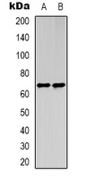 STRA8 Antibody - Western blot analysis of STRA8 expression in HEK293T (A); NIH3T3 (B) whole cell lysates.