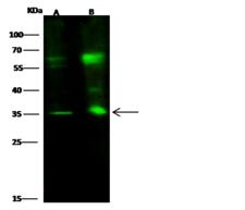 STRA8 Antibody - Anti-STRA8 rabbit polyclonal antibody at 1:500 dilution. Lane A: HEK293 Whole Cell Lysate. Lane B: 293 Whole Cell Lysate. Lysates/proteins at 30 ug per lane. Secondary: Goat Anti-Rabbit IgG H&L (Dylight800) at 1/10000 dilution. Developed using the Odyssey technique. Performed under reducing conditions. Predicted band size: 37 kDa. Observed band size: 35 kDa. (We are unsure as to the identity of these extra bands.)