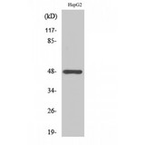 STRADA / LYK5 Antibody - Western blot of Strad antibody