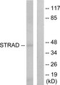 STRADA / LYK5 Antibody - Western blot analysis of lysates from HepG2 cells, using STRAD Antibody. The lane on the right is blocked with the synthesized peptide.