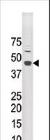 STRADA / LYK5 Antibody - The anti-LYK5 antibody is used in Western blot to detect LYK5 in mouse brain tissue lysate