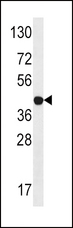 STRADA / LYK5 Antibody - The anti-LYK5 antibody is used in Western blot to detect LYK5 in Jurkat tissue lysate